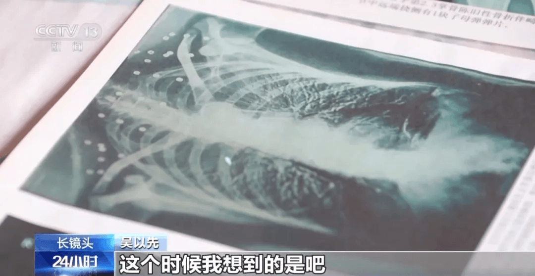 “老先生,您把项链取下来再做CT”